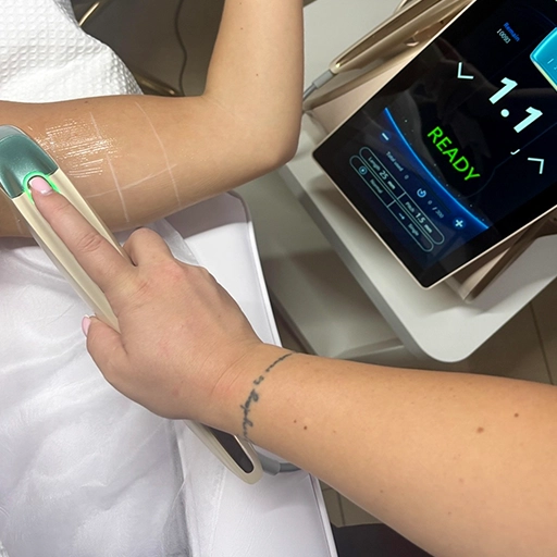 procedura_hifu12d_telo